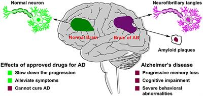Small-molecule drugs development for Alzheimer's disease